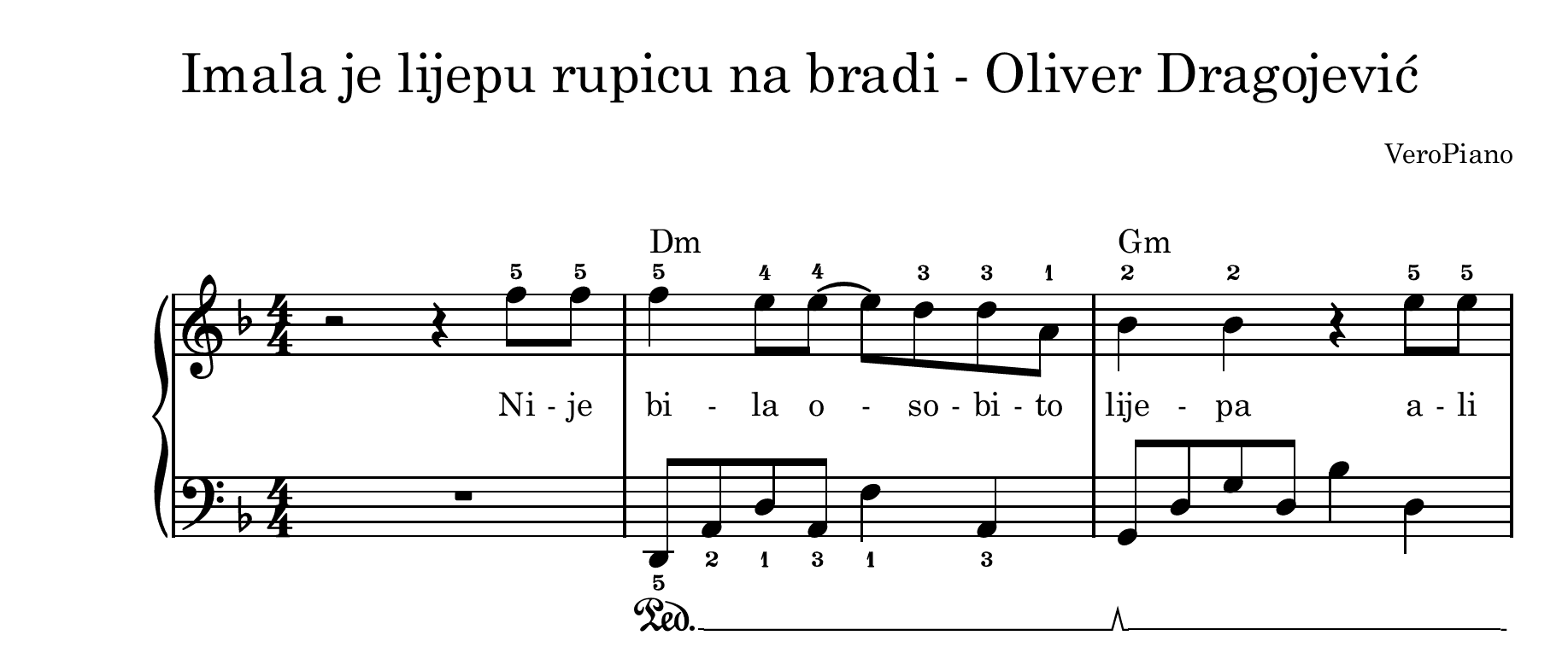 Imala je lijepu rupicu na bradi – Srednji preview