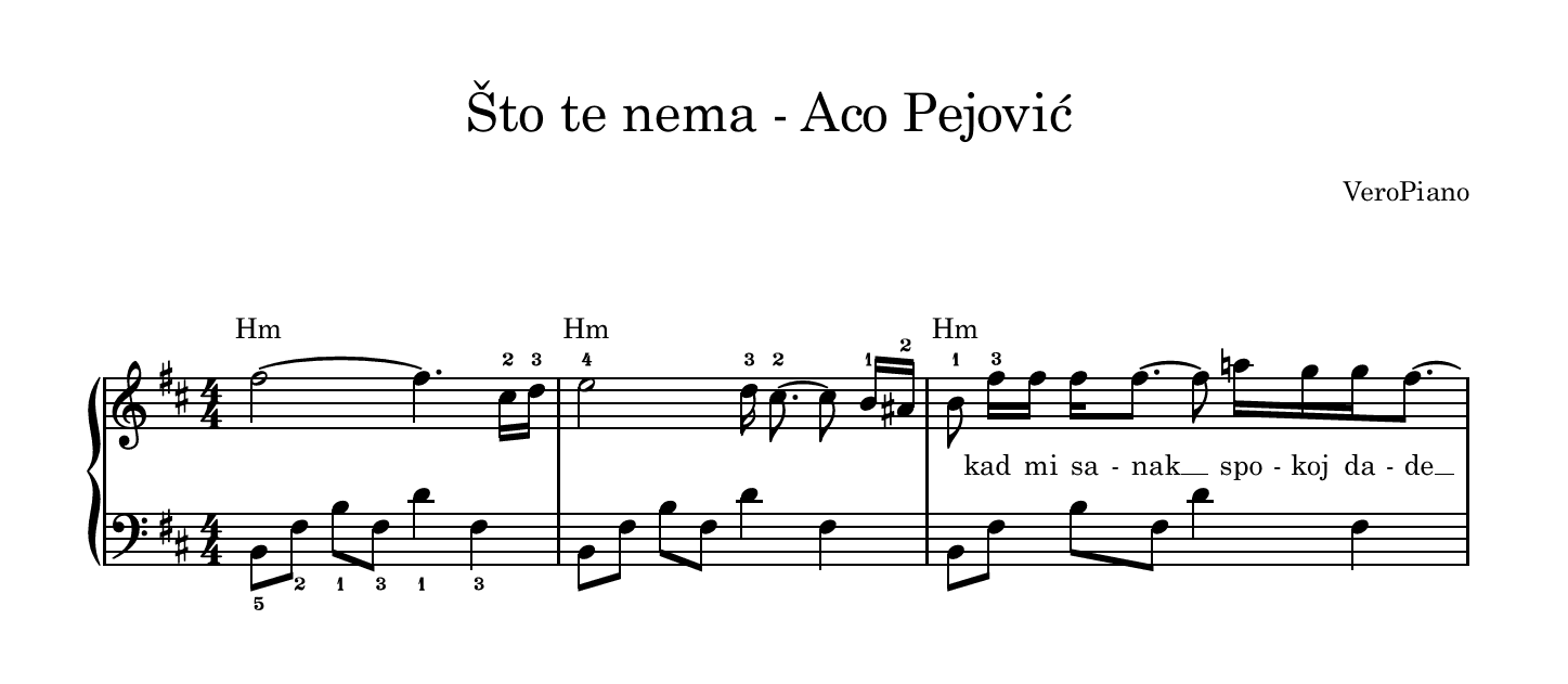 Sto te nema – Napredni preview