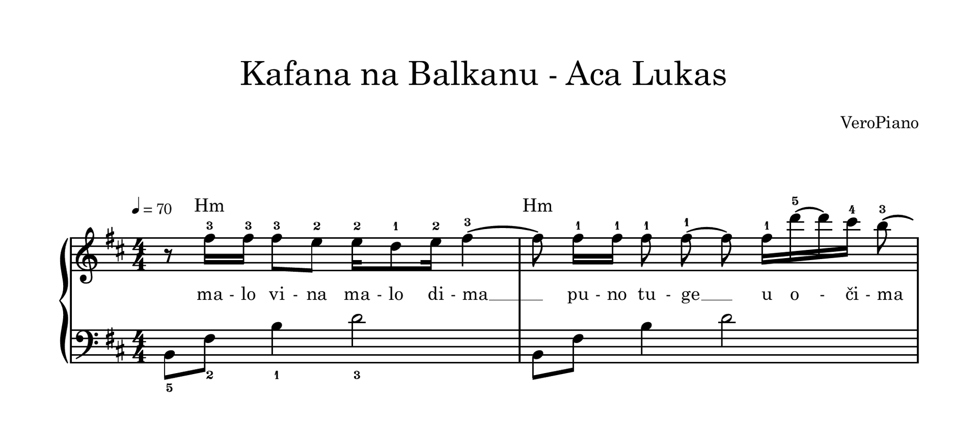 Kafana na Balkanu – Napredni preview