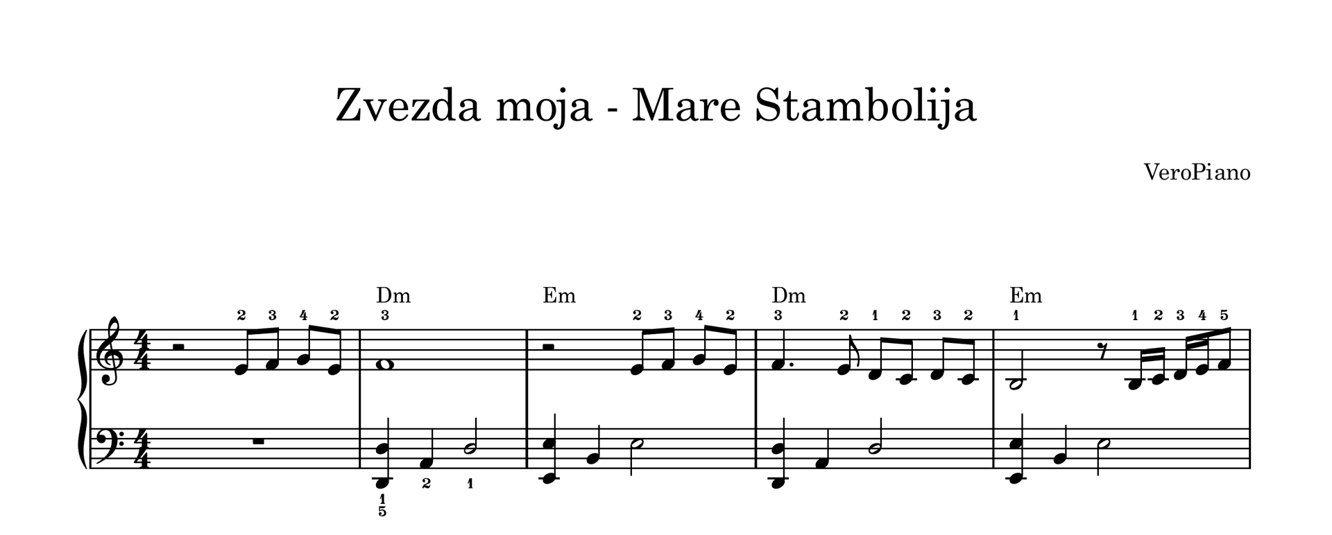 Zvezda moja – Srednji preview