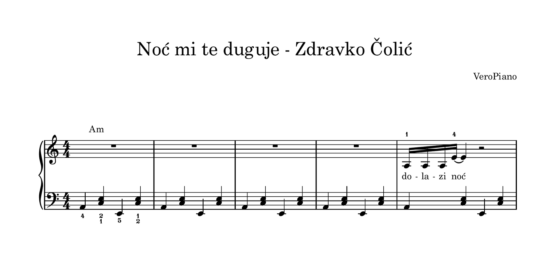 Noc mi te duguje – Napredni preview