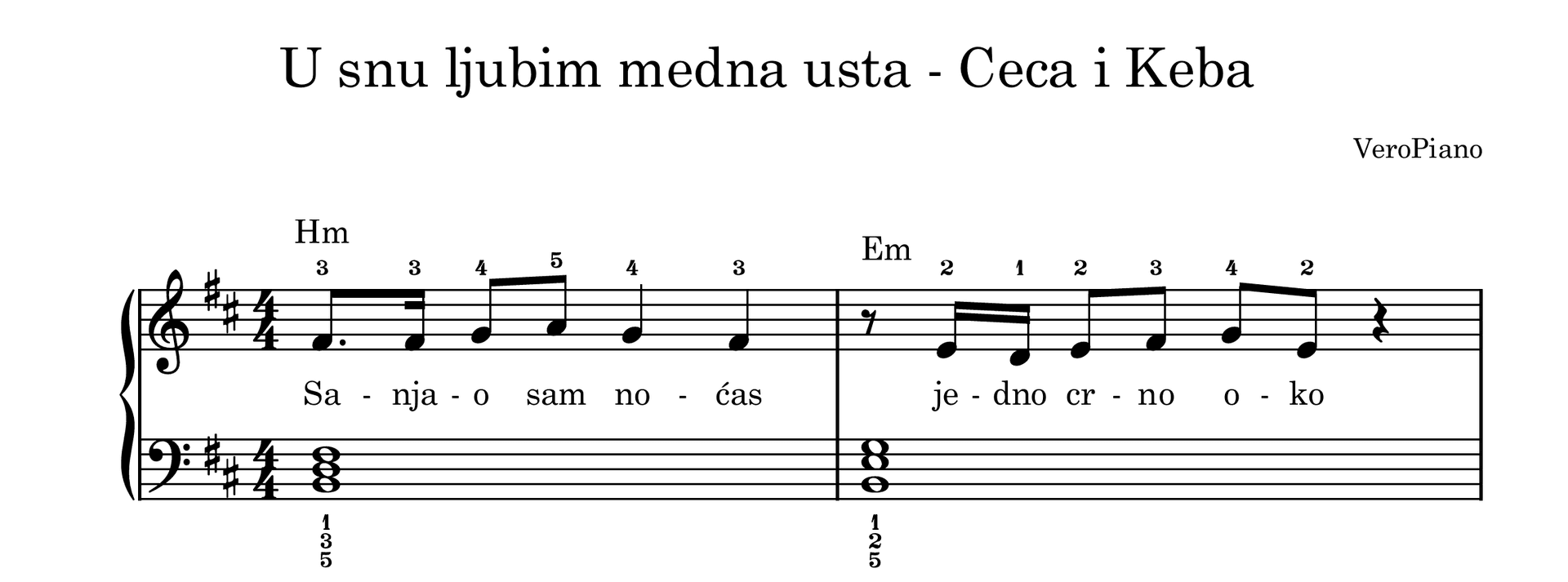 U snu ljubim medna usta – Početni preview