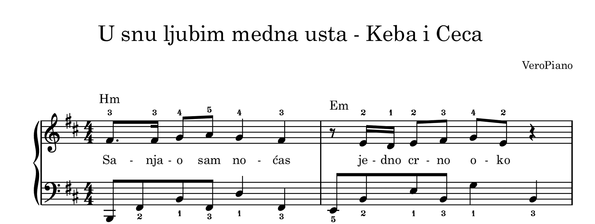 U snu ljubim medna usta – Srednji preview