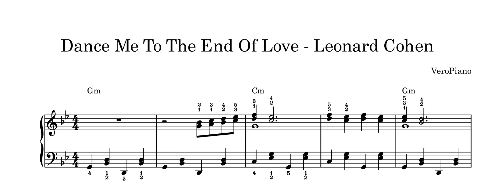 Dance Me To The End Of Love – Napredni preview