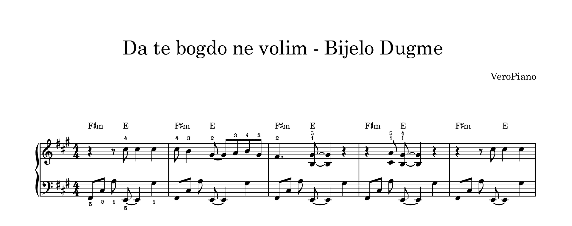 Da te bogdo ne volim – Napredni preview