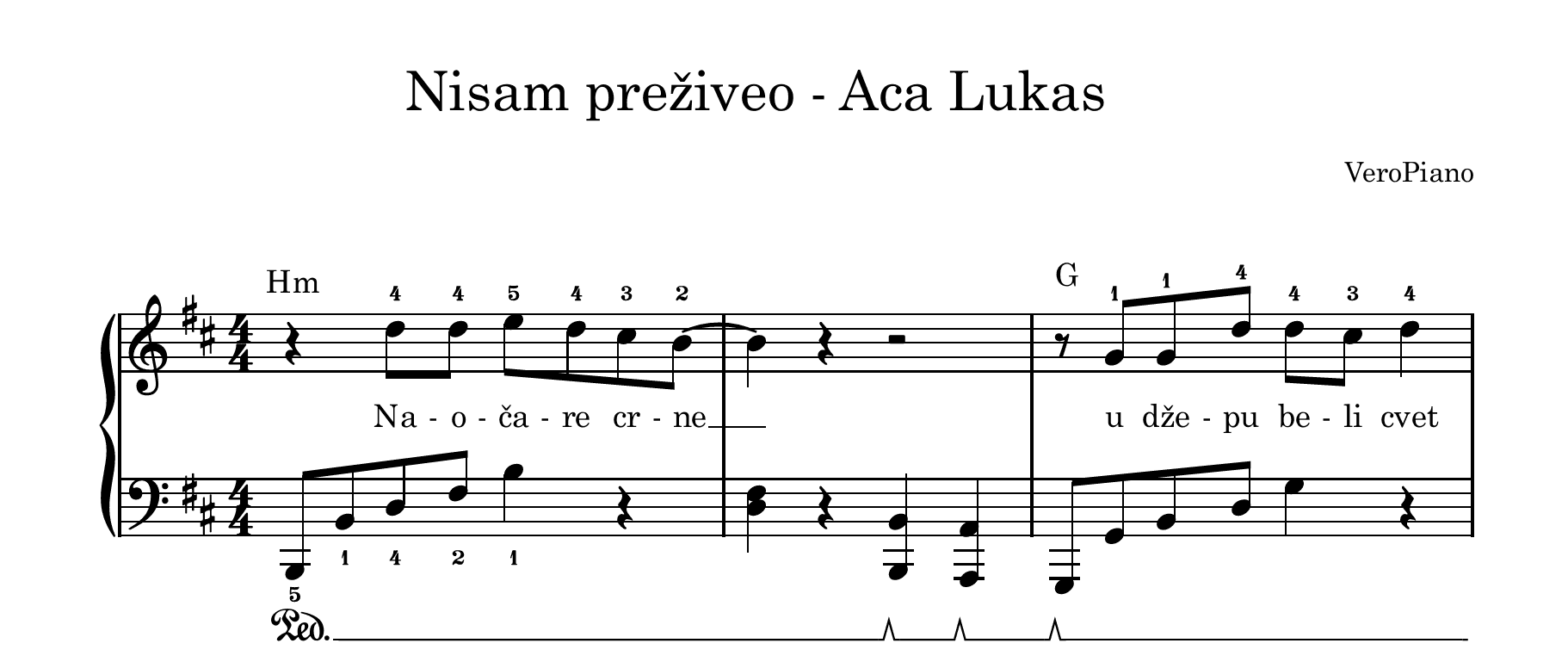 Nisam preziveo – Napredni preview