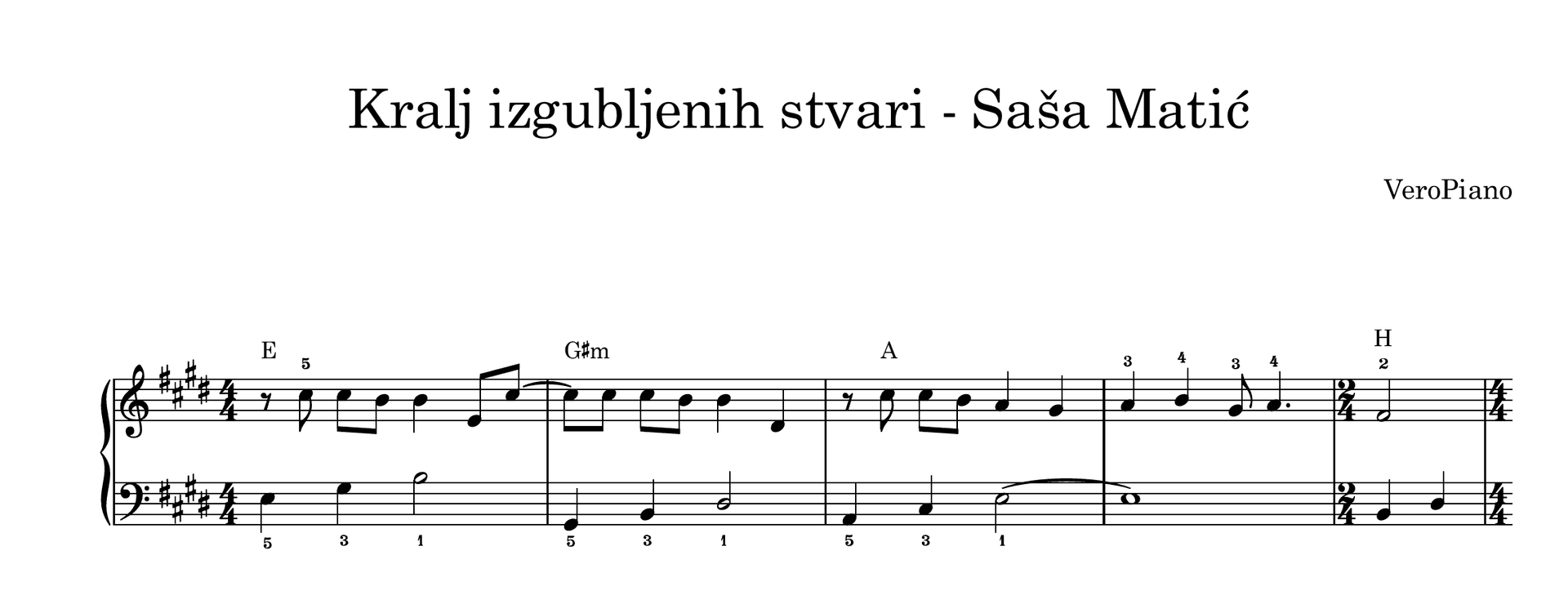 Kralj izgubljenih stvari – Početni preview