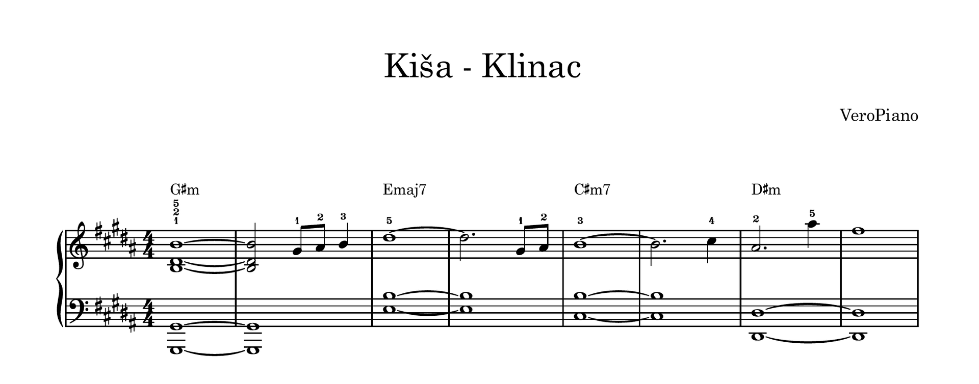 Kisa – Napredni preview