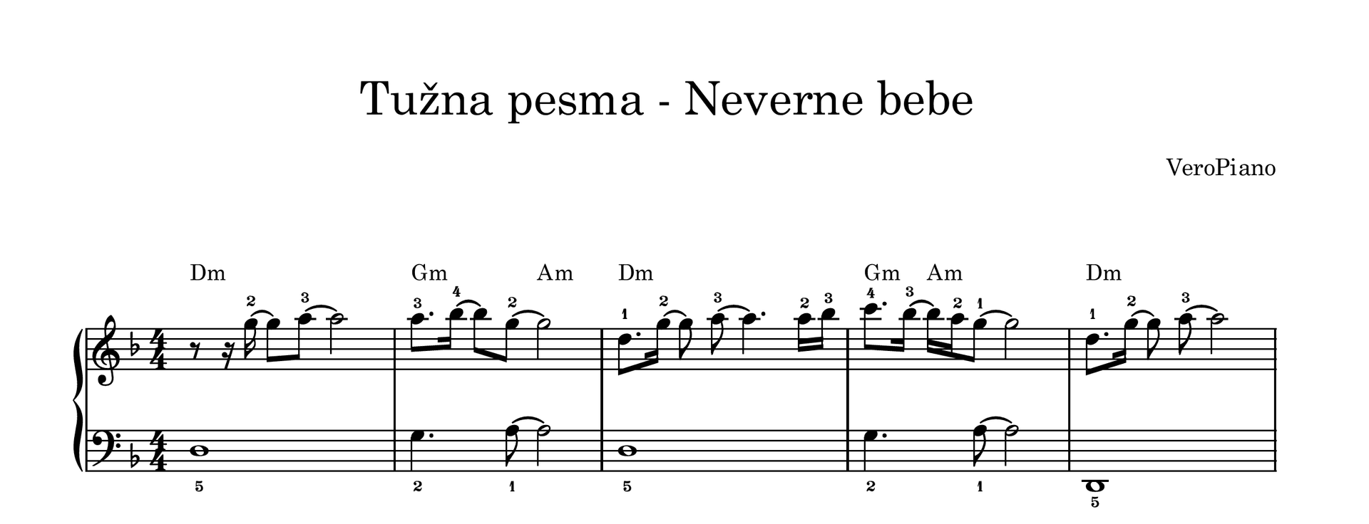 Tuzna pesma – Početni preview