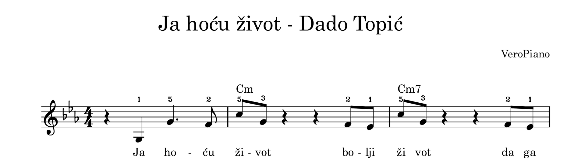 Ja hocu zivot – Početni preview