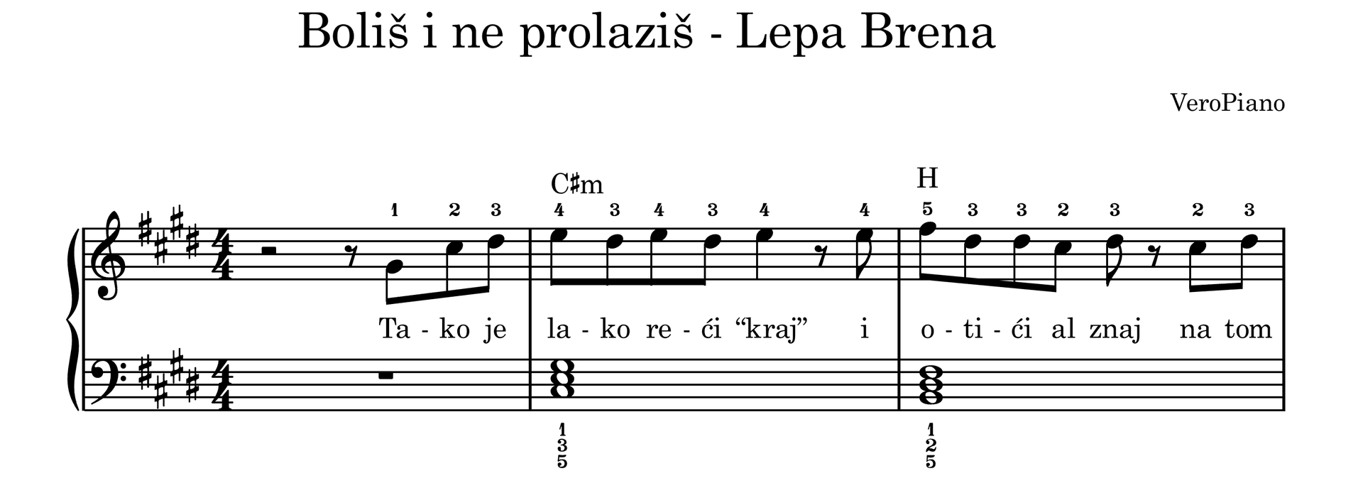 Bolis i ne prolazis – Početni preview