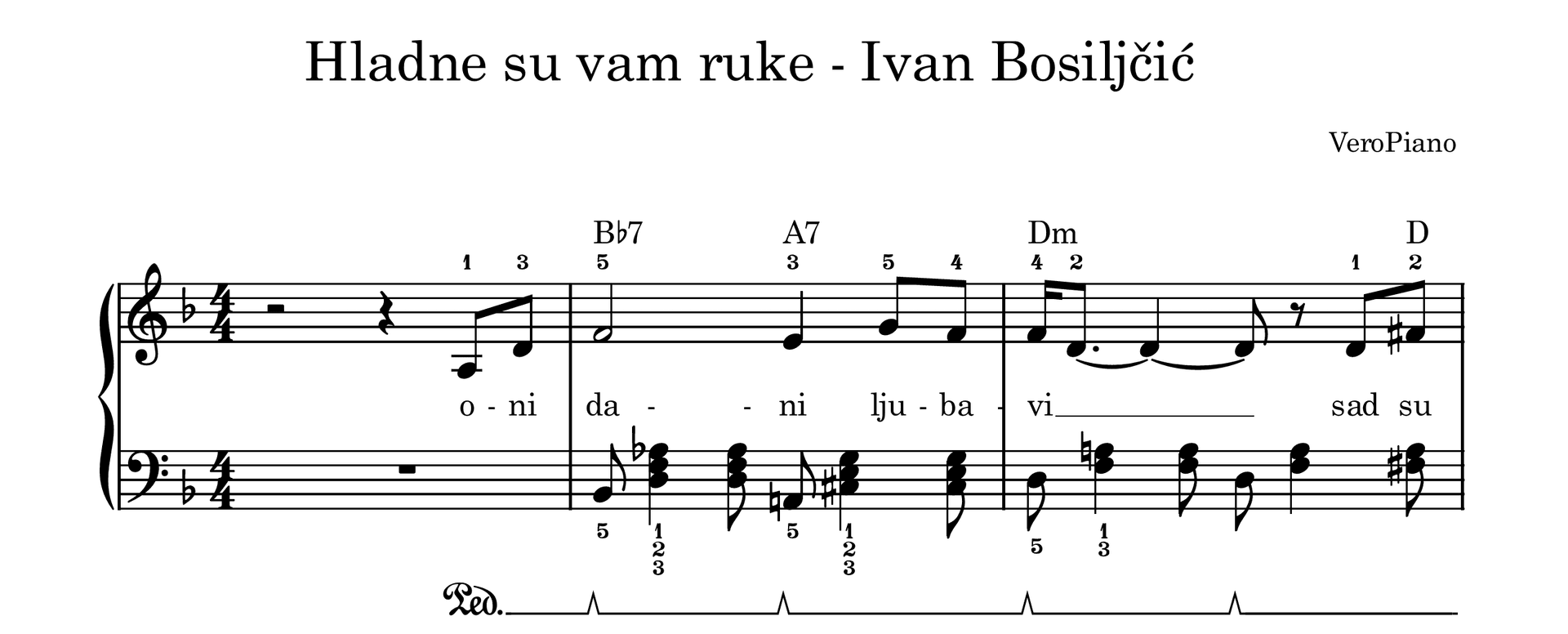 Hladne su vam ruke – Srednji preview