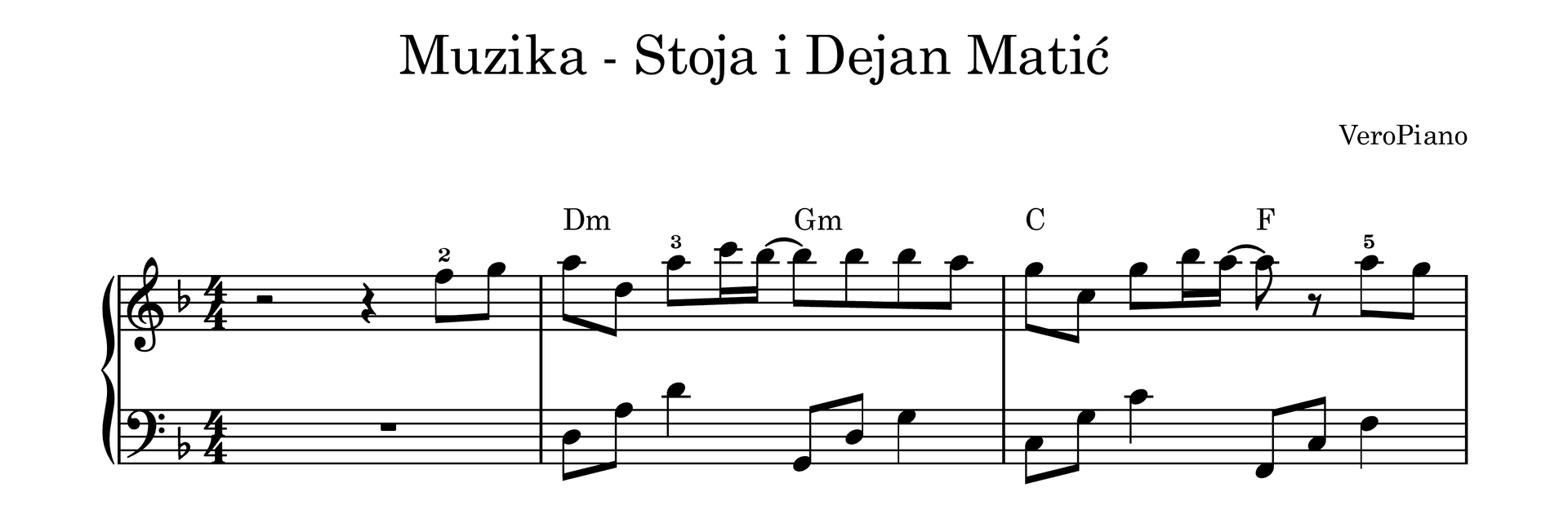 Muzika – Napredni preview