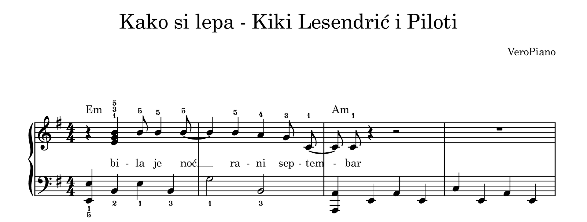 Kako si lepa – Napredni preview